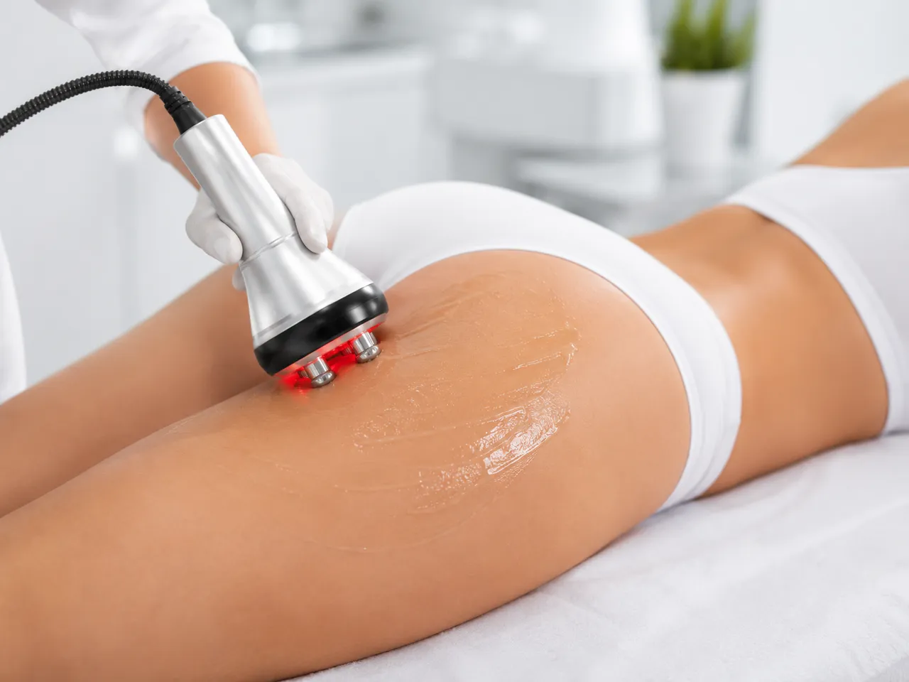Cellulite reduction treatment being performed at the Gold Coast clinic