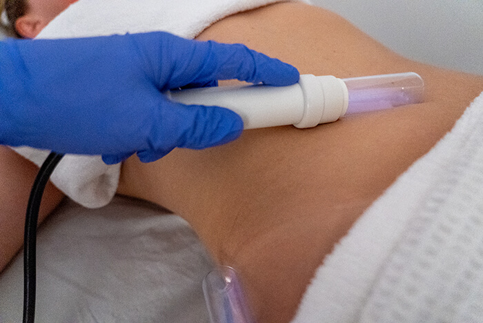 Electro Lymphatic Enhancement Therapy 2