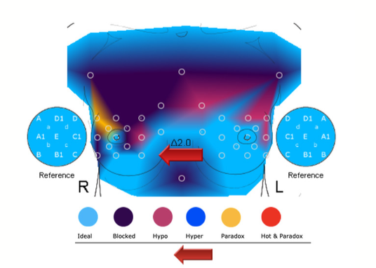 digital-thermography3
